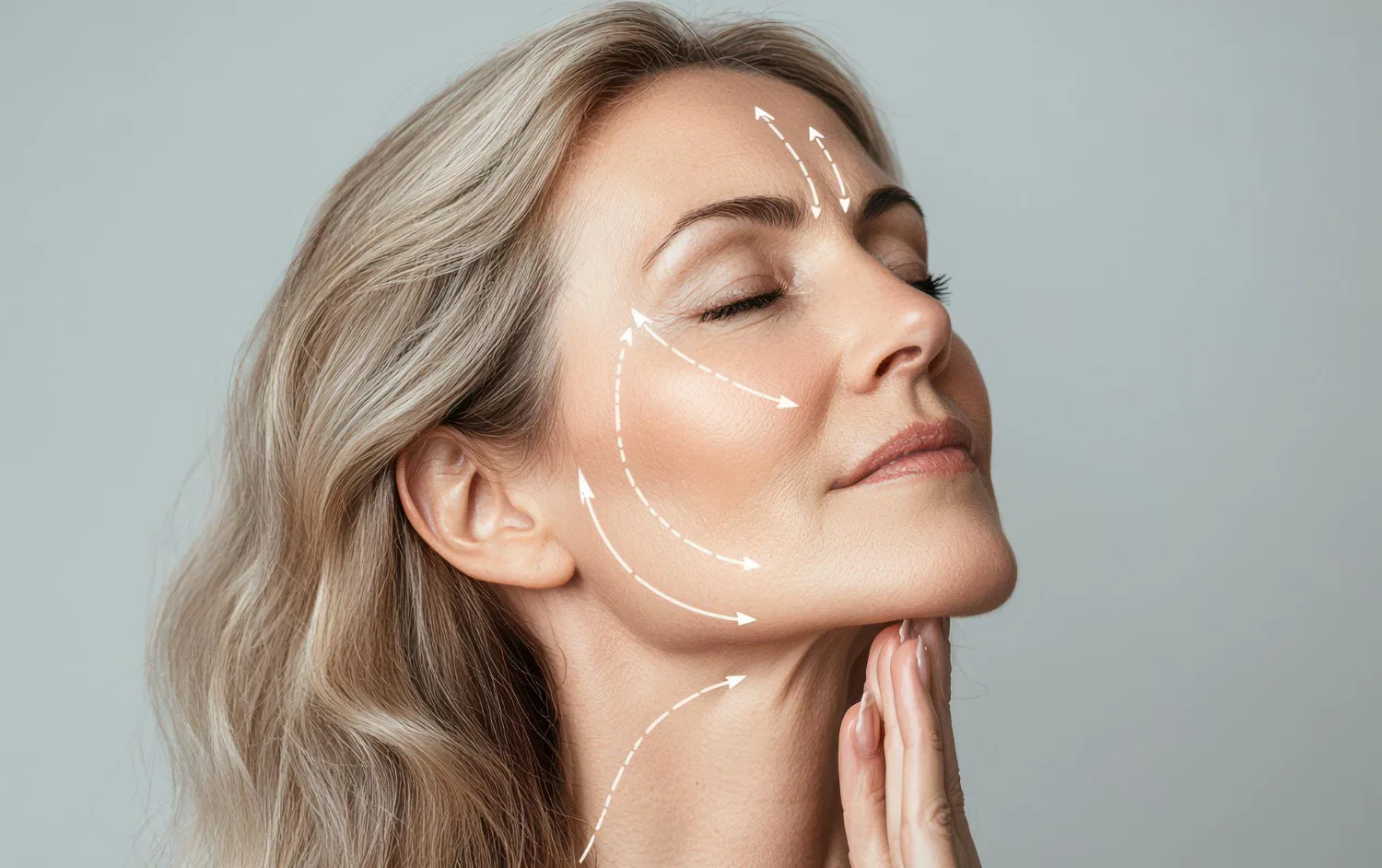 Facelift