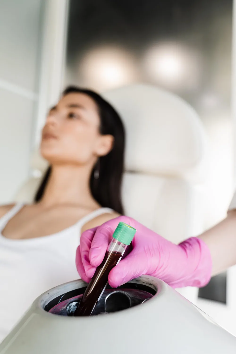 PRP Eigenbluttherapie